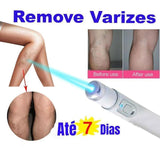 VariLaser - Caneta Laser Removedora de Varizes